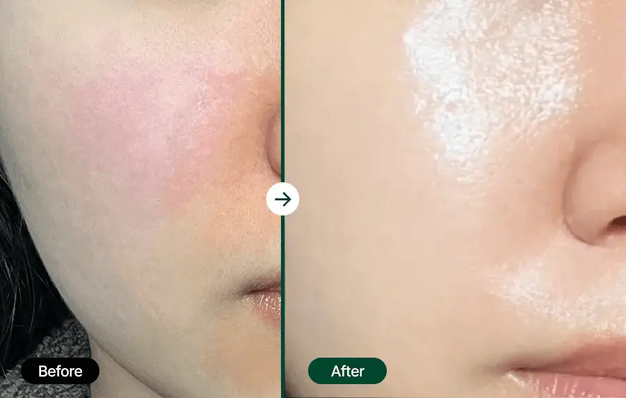[7월올영픽] 닥터지 레드블레미쉬 클리어 수딩크림 EX 70ml기획 (+30ml+세럼10ml*2ea) 상세페이지 28